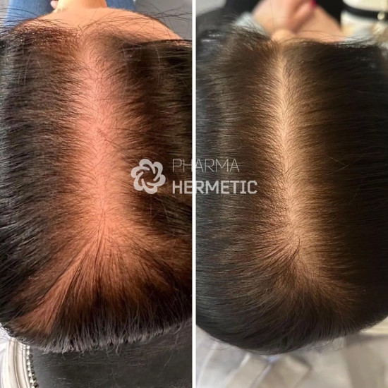 Matu atjaunošanas programma SP55, Pharma Hermetic / 10 ampulas × 2 ml