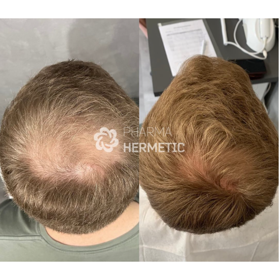 Лосьон-спрей против выпадения волос SP55, Pharma Hermetic / 50 мл